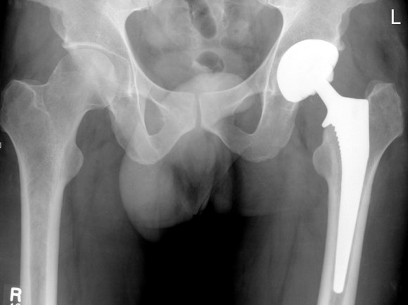 pic_x-uncem-thr_01_big